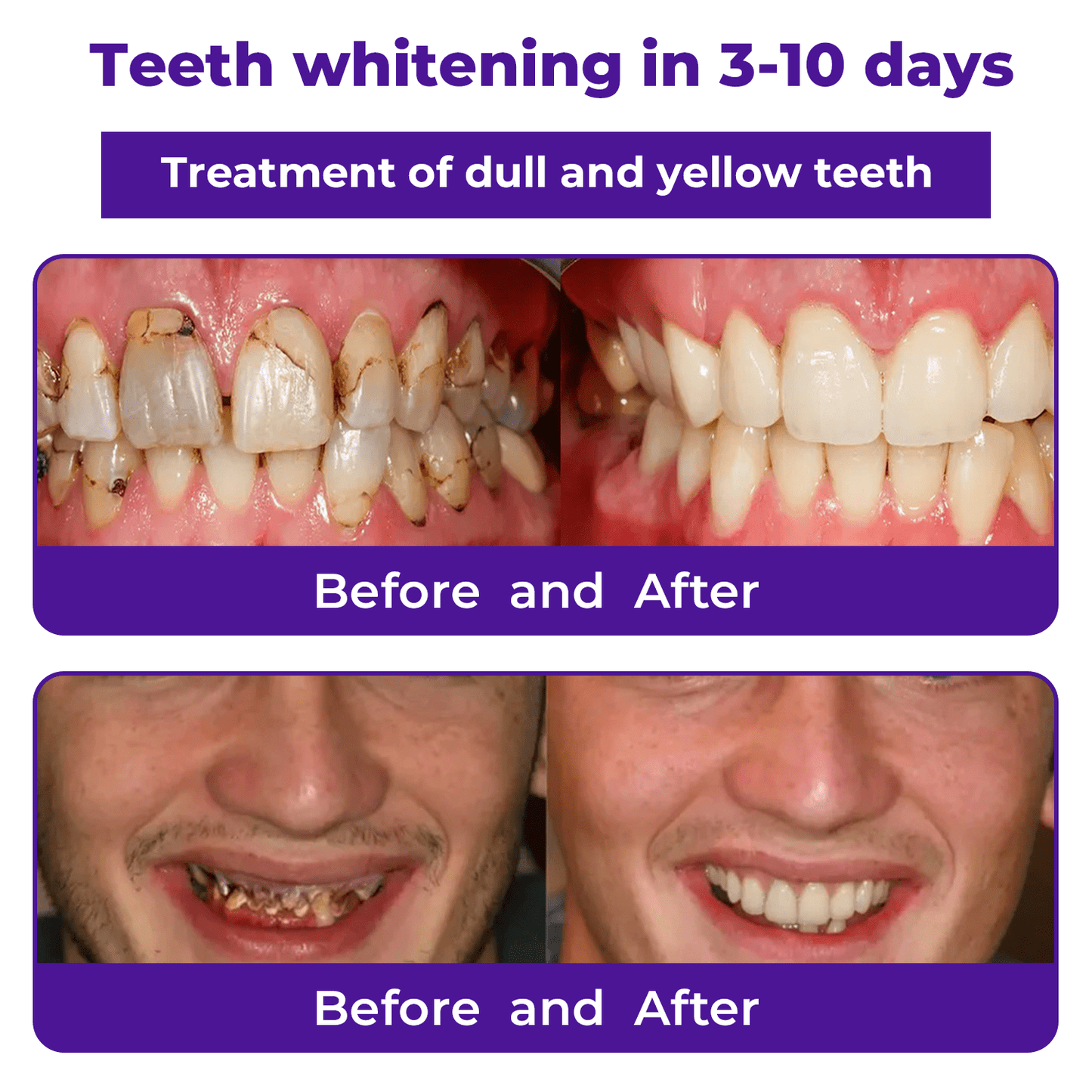 Unixate™ Dental Repair Mineral Powder 🍊